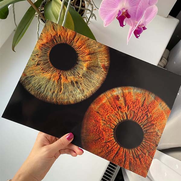 Фотографии радужки глаза от студии Your-Eyes Фотографии радужки глаза от студии Your-Eyes